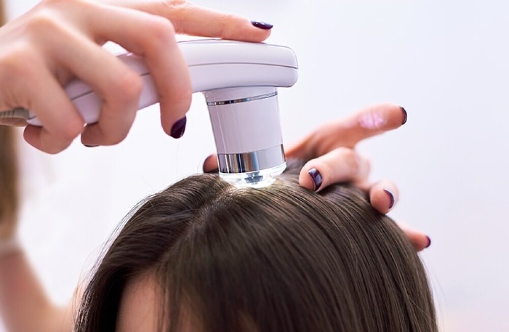 【ダヴィネス】ブログ限定！頭皮スコープ無料実施中✨