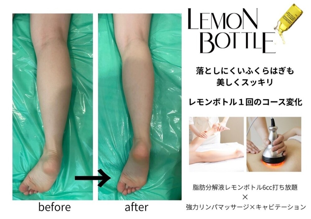 大人気レモンボトルBODY