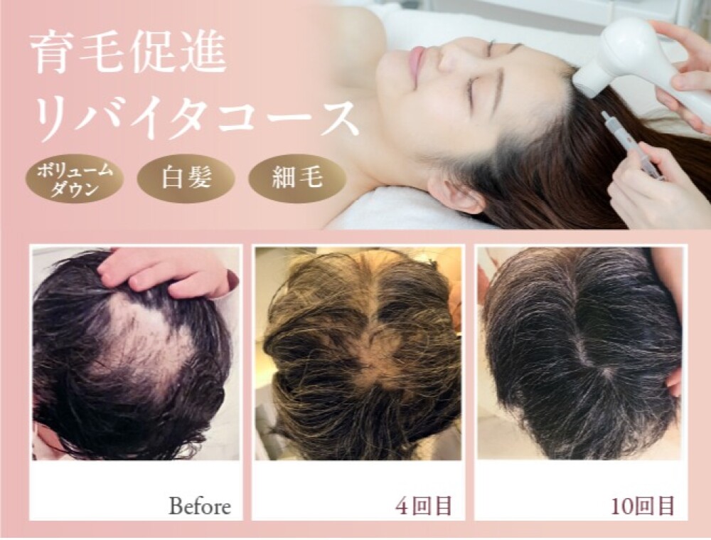 髪・頭皮のお悩みありませんか