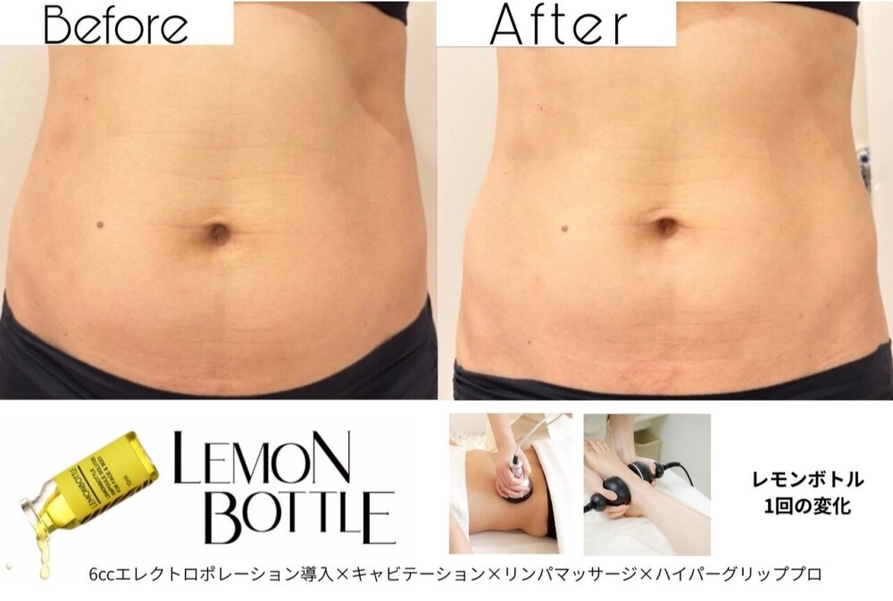大人気レモンボトルBODY