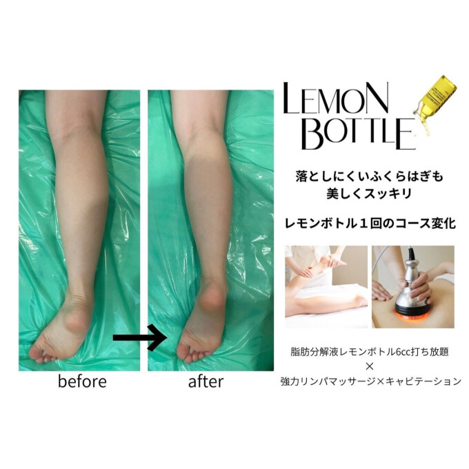 大人気レモンボトルBODY