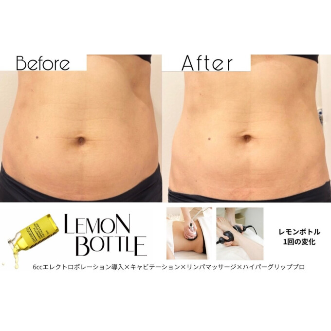大人気レモンボトルBODY